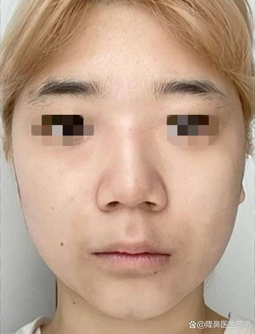 广州华美医学整形美容医院擅长项目: