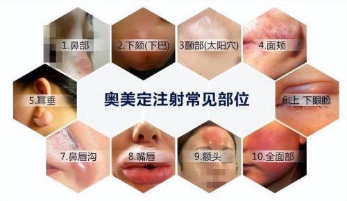 泰州太喜柏丽医疗美容诊所价格表：