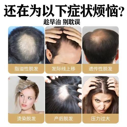 姜镇秀医生技术优势: