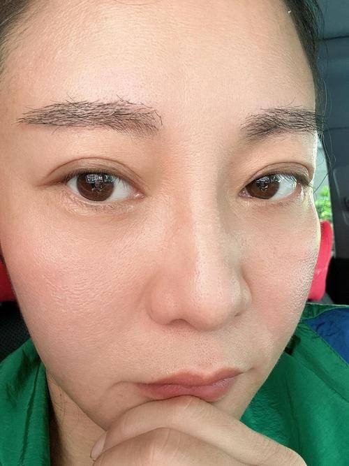 杭州碧莲盛植发医院医生名单及擅长领域：