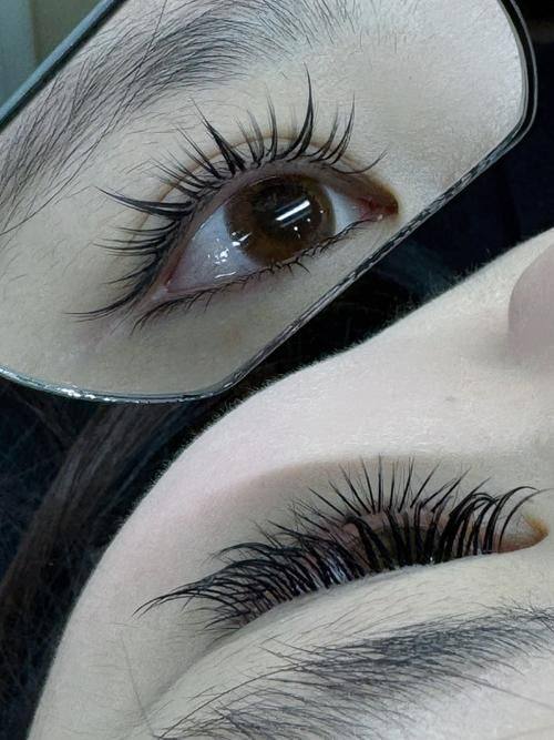 郑钟连医生擅长领域: