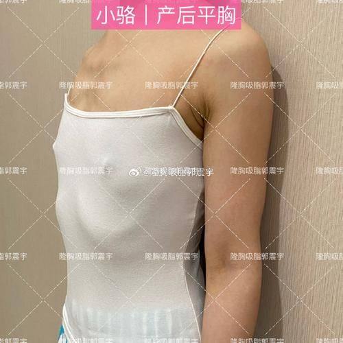 贵阳人剧医疗美容诊所擅长项目：