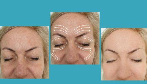 张东勤医生技术优势: