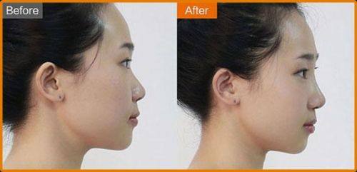 韩国Smile整形外科医院口碑评价: