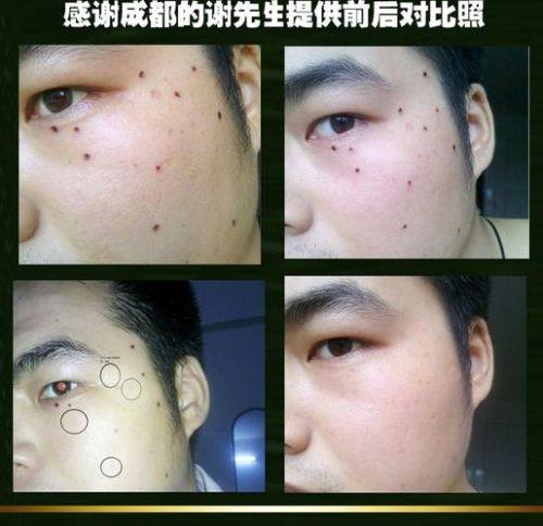 泰州太喜柏丽医疗美容诊所擅长项目：