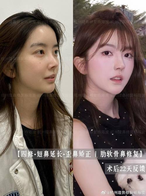 上海大嘉医疗美容门诊部价格表：