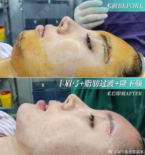 福州汇美整形美容医院预约挂号方式：