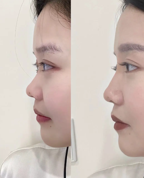 贵阳人剧医疗美容诊所怎么样？