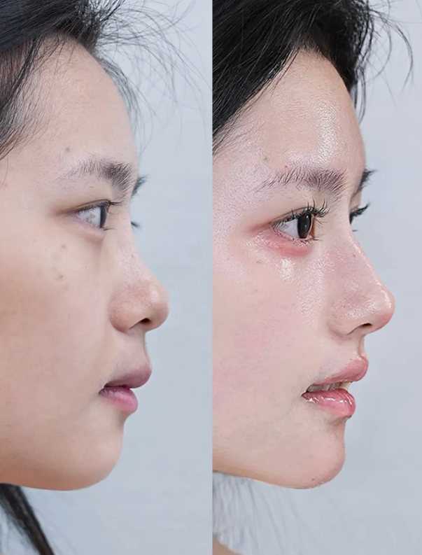 长沙如美整形医院医生名单及擅长领域：