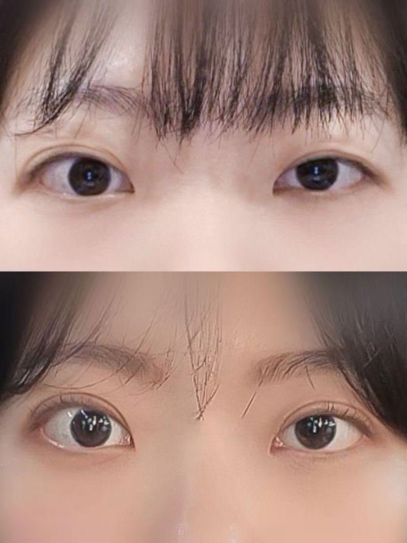 长沙如美整形医院怎么样？