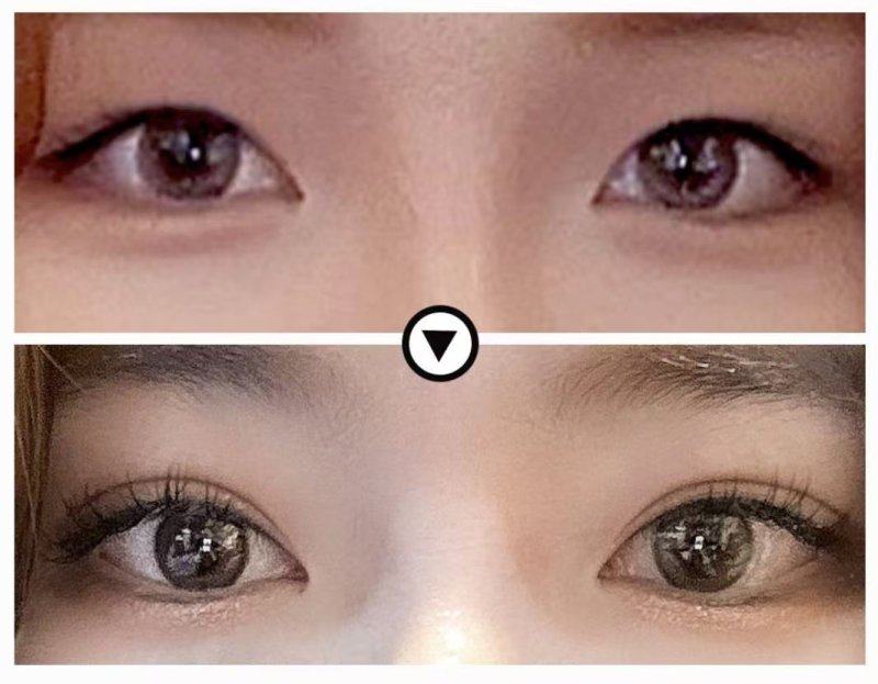 福州汇美整形美容医院地址电话及营业时间：