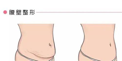 詹繁荣医生技术优势