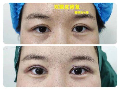 深圳格瑞斯医疗美容门诊部擅长项目