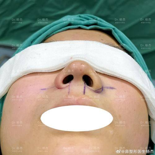 西宁王观民医疗美容诊所医生名单及擅长领域: