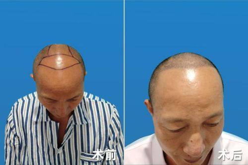 西宁王观民医疗美容诊所价格表