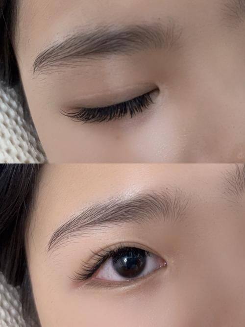 广州新发现植发连锁机构价格表: