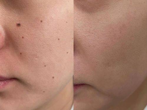 西宁王观民医疗美容诊所口碑评价