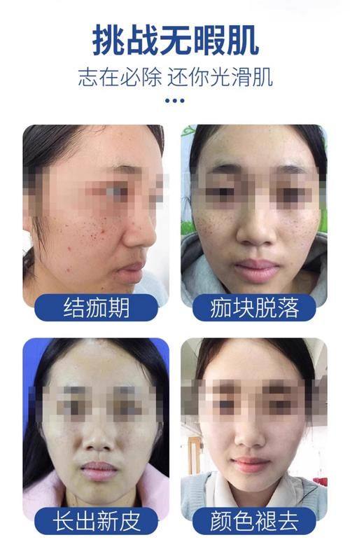 西宁王观民医疗美容诊所预约挂号方式