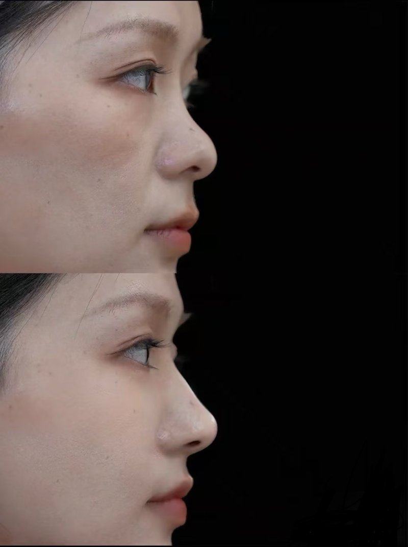 哈尔滨大美整形医疗美容门诊部价格表：