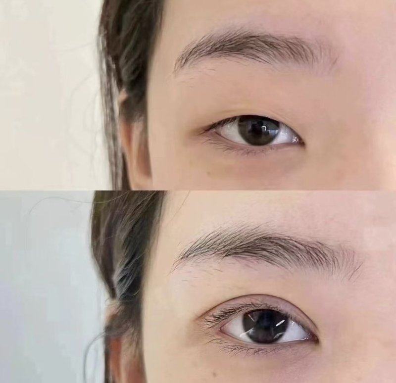 郭刚医生技术优势