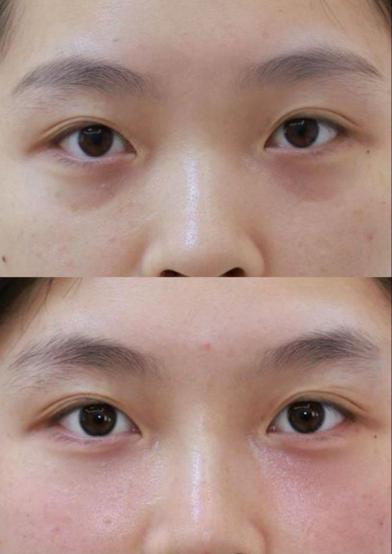 四、长效维持需要的微调与护理方案